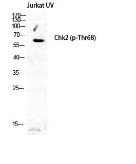 Phospho-Chk2 (Thr68)