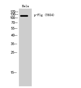 Phospho-FGFR1 (Tyr654)