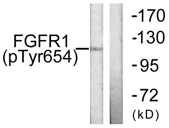 Rabbit Polyclonal Antibody to Phospho-FGFR1 (Tyr654)