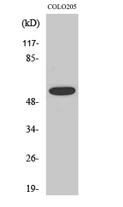 Phospho-AKT (Thr308)