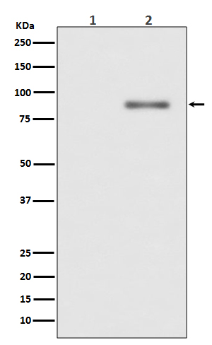 Phospho-PKC alpha (Thr638)