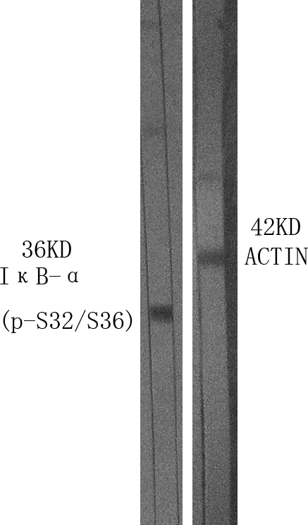 Phospho-IKB alpha (Ser32/Ser36)