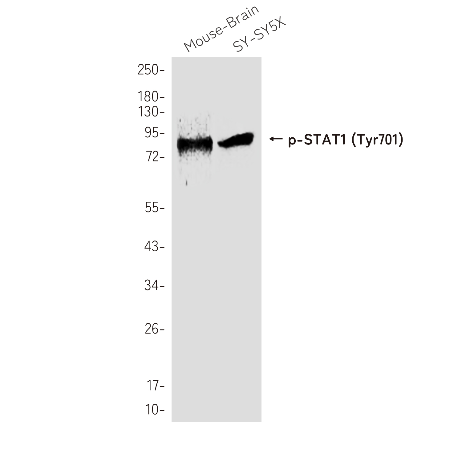 Phospho-STAT1 (Tyr701)