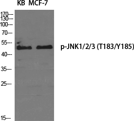 Phospho-JNK (Thr183/Tyr185)
