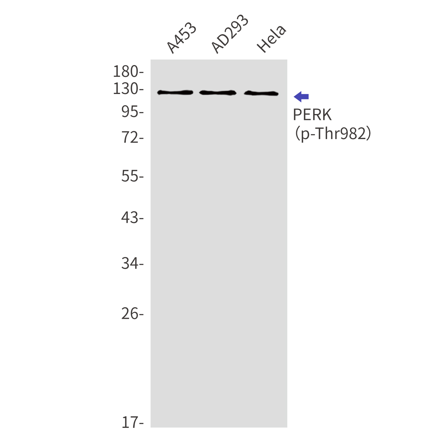Phospho-PERK (Thr982)