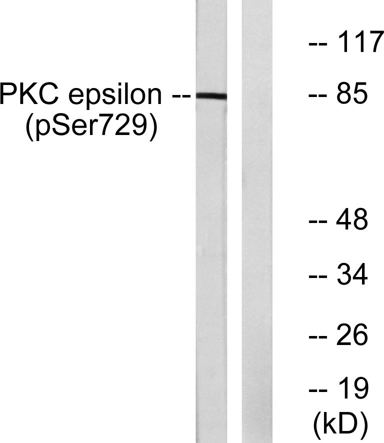 Phospho-PKC epsilon (Ser729)