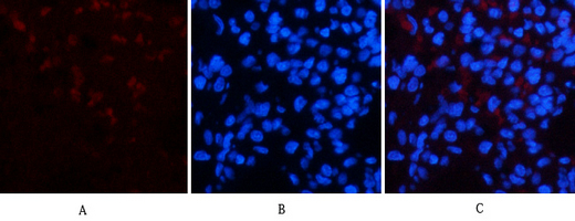 Mouse Monoclonal Antibody to CD23