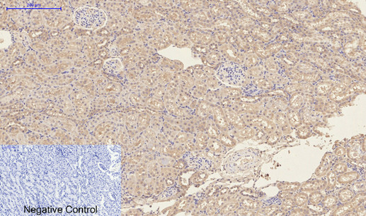 Mouse Monoclonal Antibody to CD23