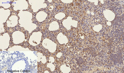 Mouse Monoclonal Antibody to CD23