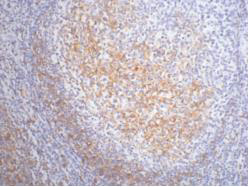 Mouse Monoclonal Antibody to CD23