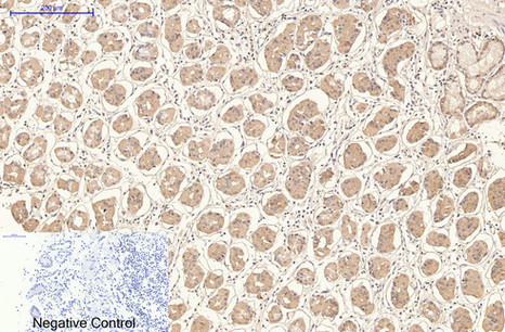 Mouse Monoclonal Antibody to CD21