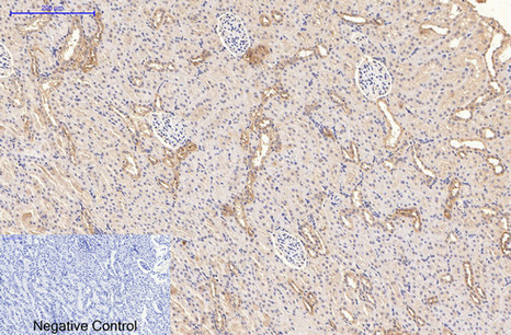 Mouse Monoclonal Antibody to CD21