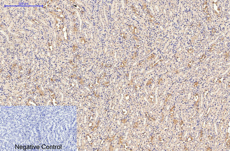 Mouse Monoclonal Antibody to CD21
