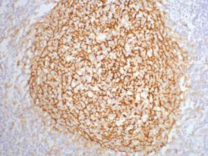 Mouse Monoclonal Antibody to CD21
