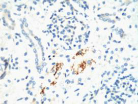 Mouse Monoclonal Antibody to KIF7