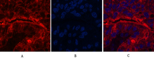 CD15