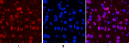 Mouse Monoclonal Antibody to Progesterone Receptor