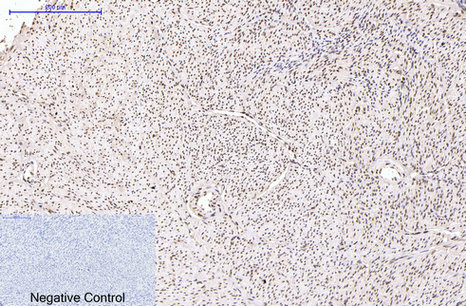 Mouse Monoclonal Antibody to Progesterone Receptor