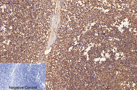 Mouse Monoclonal Antibody to CD1a