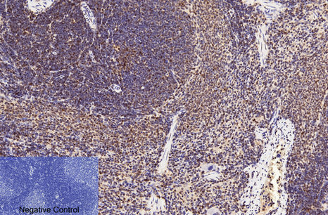 Mouse Monoclonal Antibody to CD2