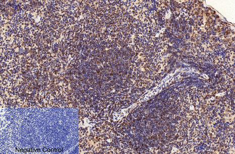 Mouse Monoclonal Antibody to CD2
