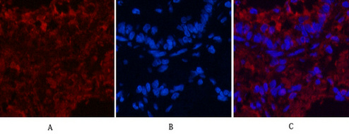Mouse Monoclonal Antibody to CD4