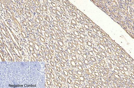 Mouse Monoclonal Antibody to CD4