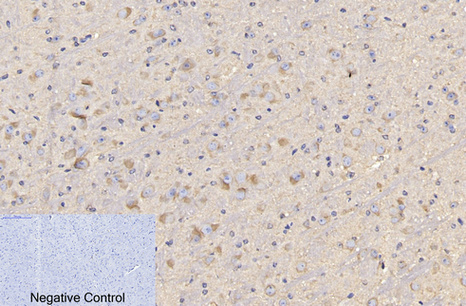 Mouse Monoclonal Antibody to CD4