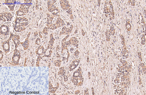 Mouse Monoclonal Antibody to CD5