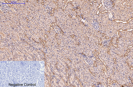 Mouse Monoclonal Antibody to CD5