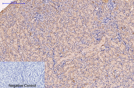 Mouse Monoclonal Antibody to CD5