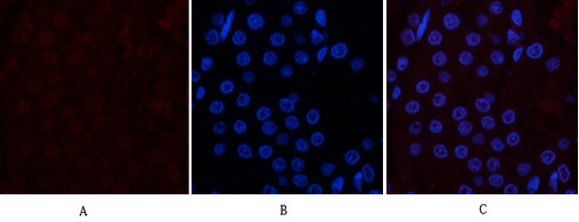 Mouse Monoclonal Antibody to CD10
