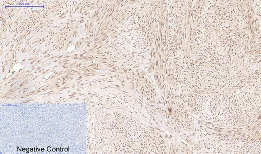 Mouse Monoclonal Antibody to CD10