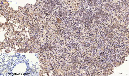 Mouse Monoclonal Antibody to CD10