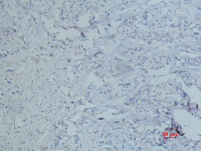 Mouse Monoclonal Antibody to CD10