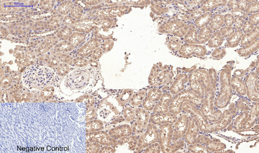 Mouse Monoclonal Antibody to CD10