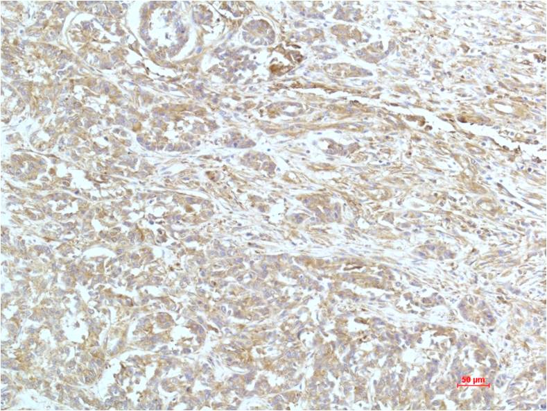 alpha Actinin