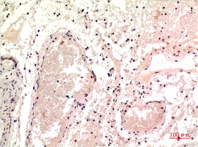 gamma Tubulin