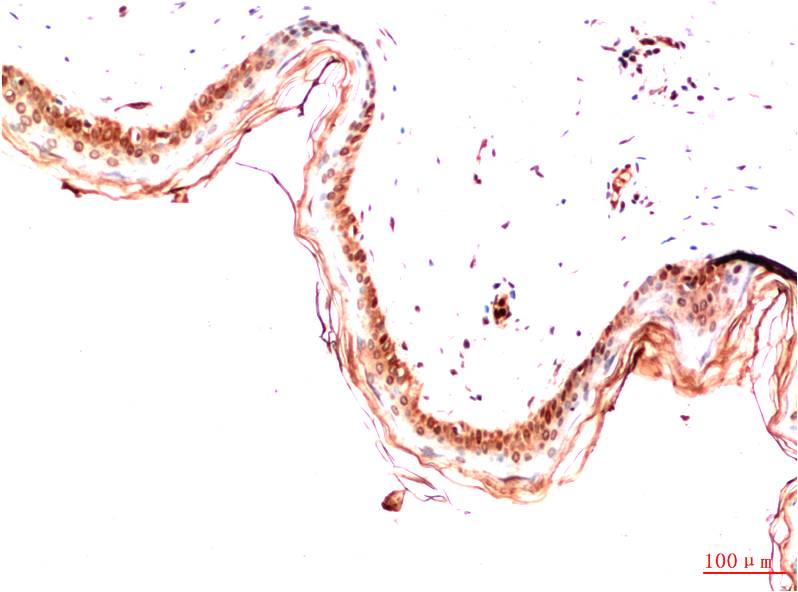 Mouse Monoclonal Antibody to PDGFR alpha