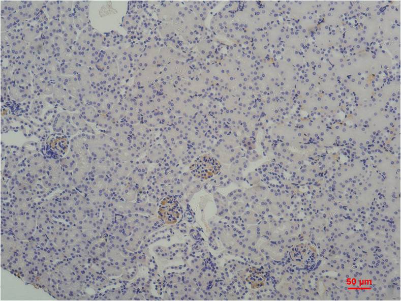 TATA Box Binding Protein