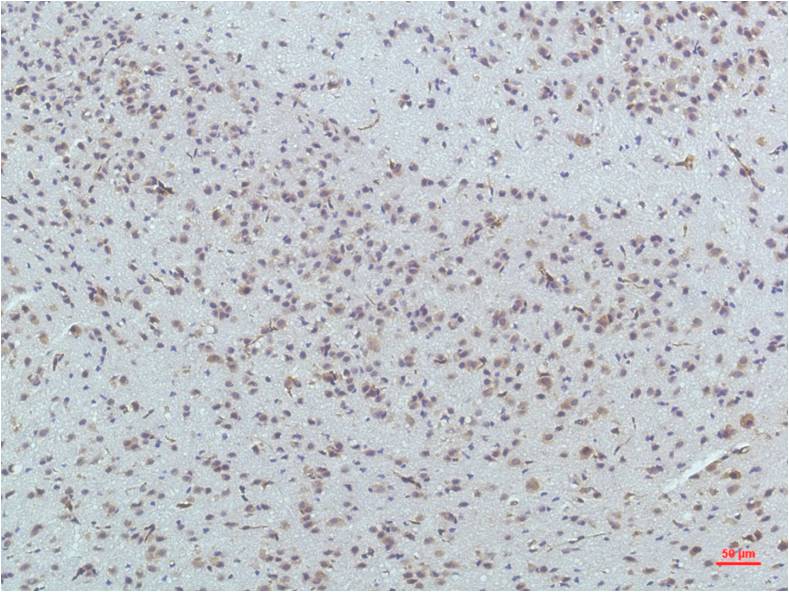Mouse Monoclonal Antibody to PPAR delta