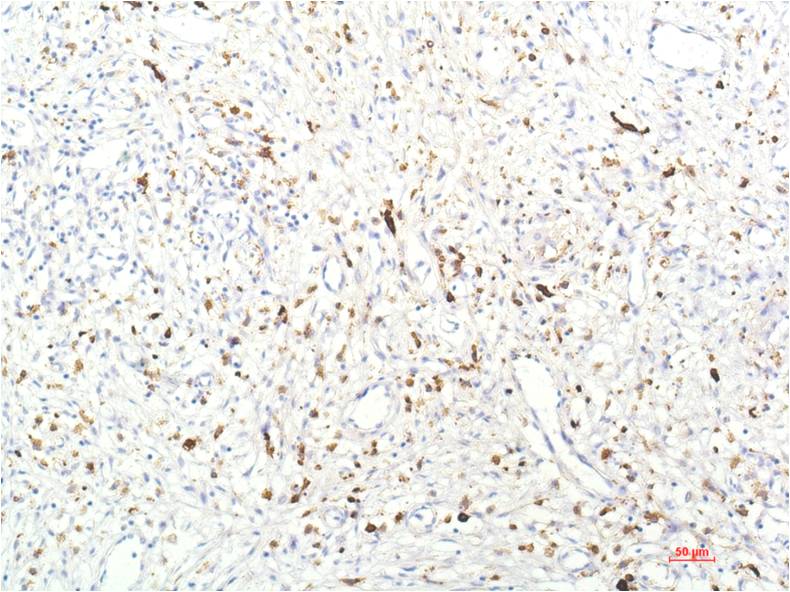 Mouse Monoclonal Antibody to JAK1