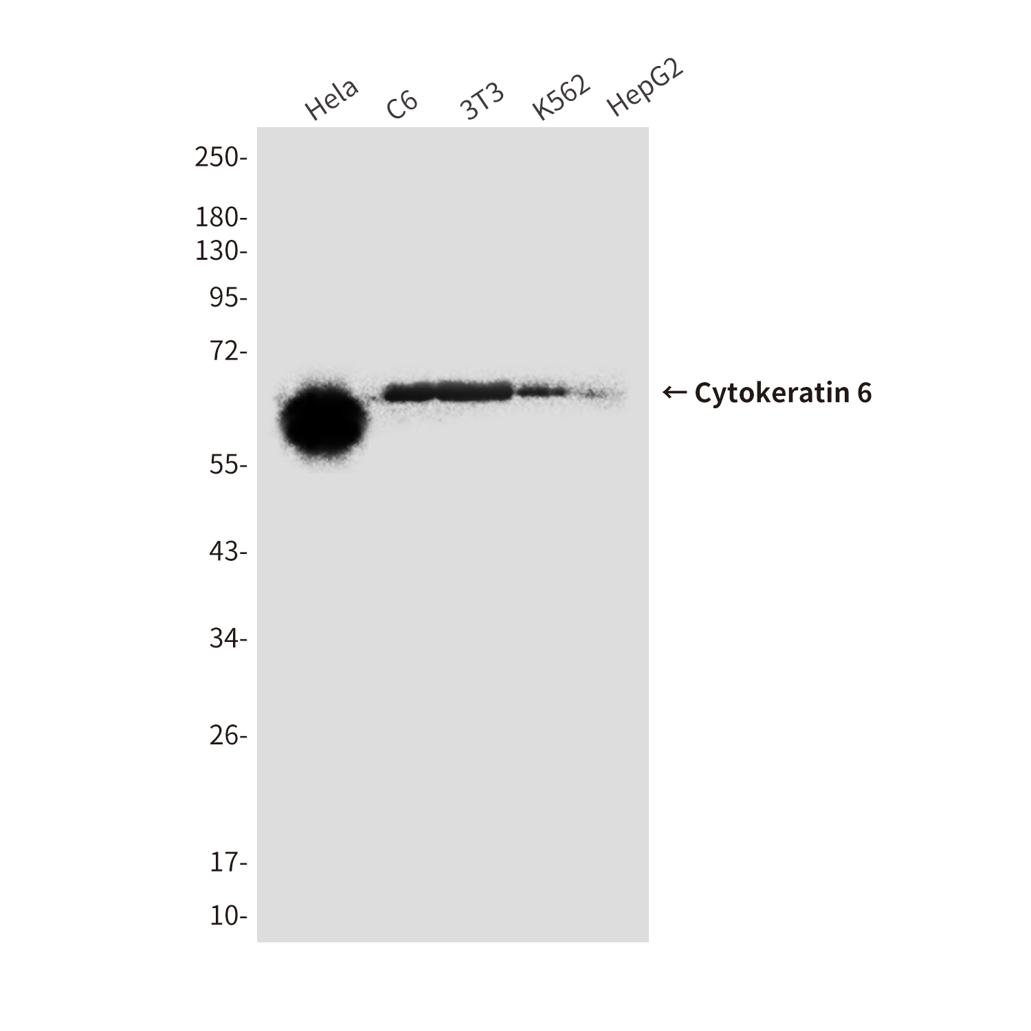 Cytokeratin 6