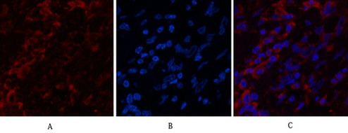 Mouse Monoclonal Antibody to Cytokeratin 6