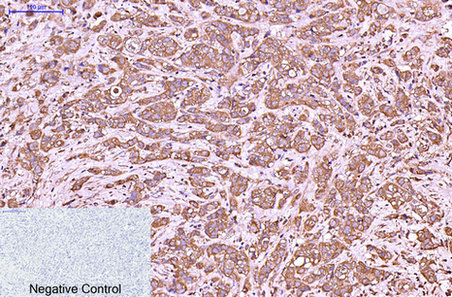 Mouse Monoclonal Antibody to Cytokeratin 6