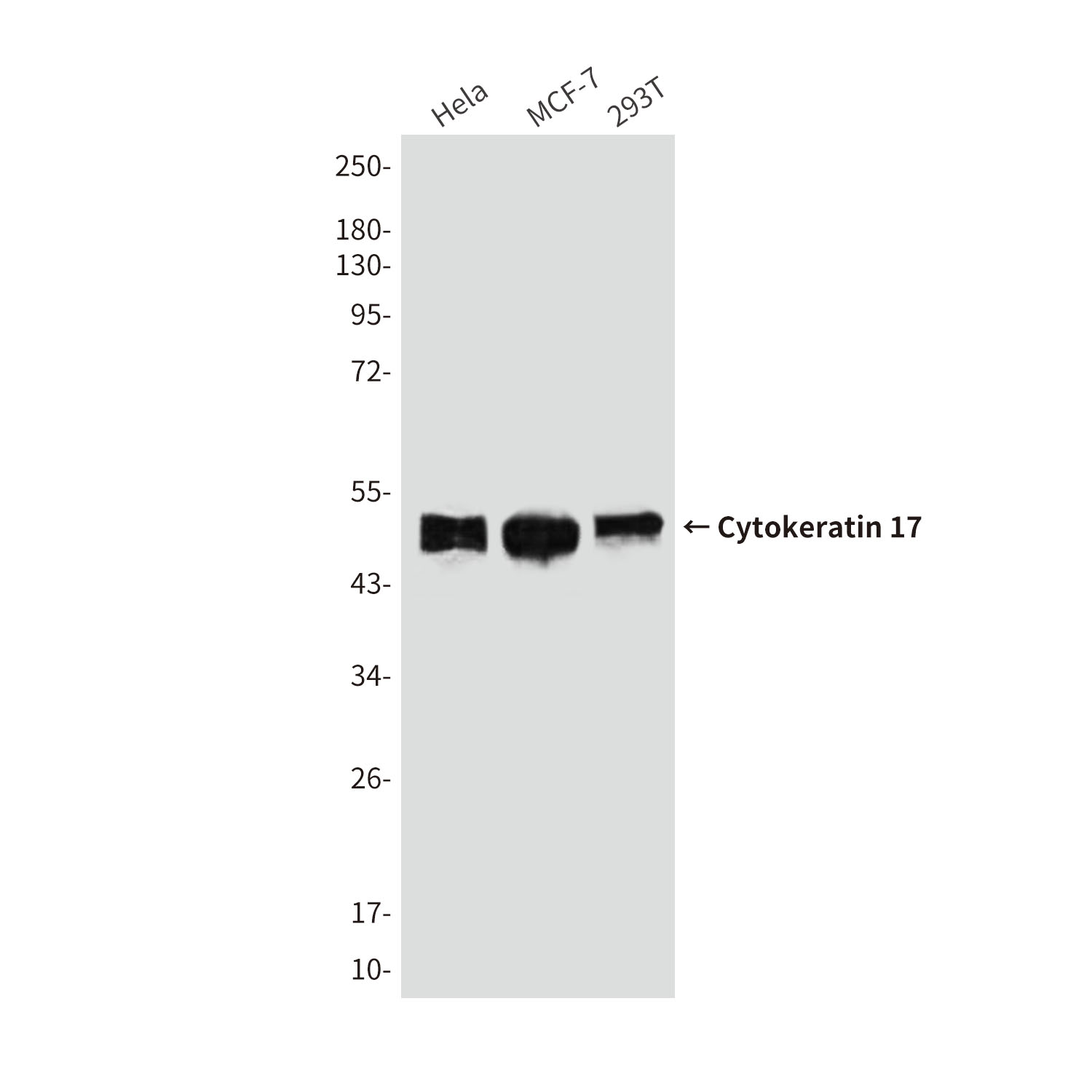 Cytokeratin 17
