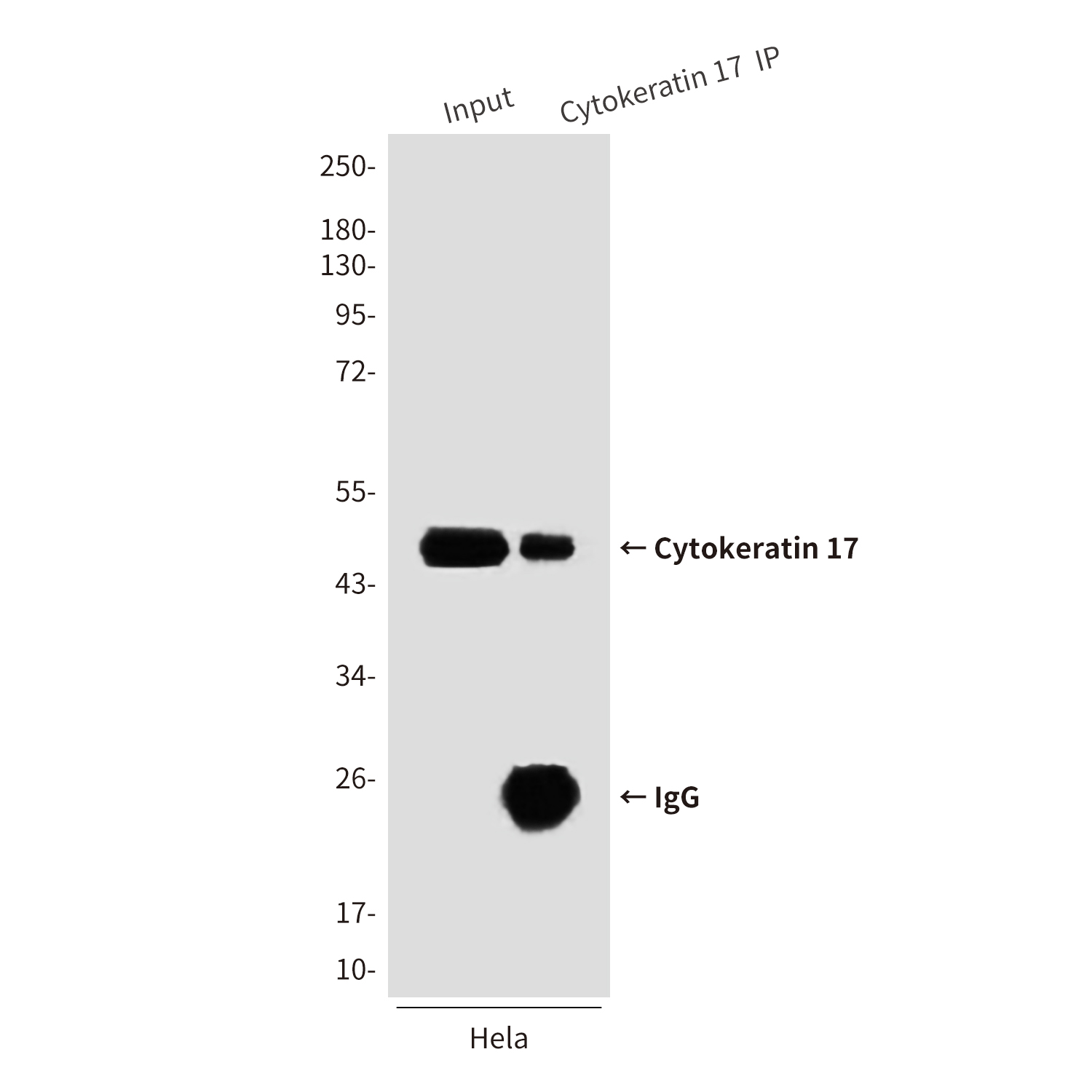 Mouse Monoclonal Antibody to Cytokeratin 17