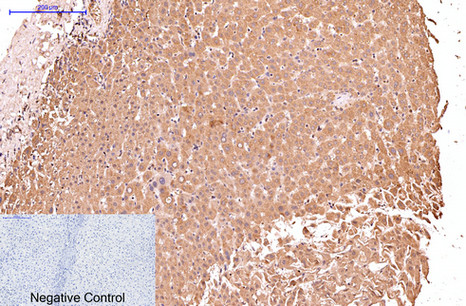 Mouse Monoclonal Antibody to Cytokeratin 17