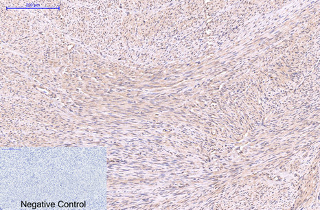 Mouse Monoclonal Antibody to EFHD1