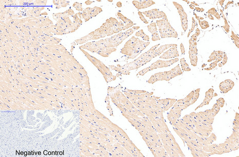 Mouse Monoclonal Antibody to EFHD1